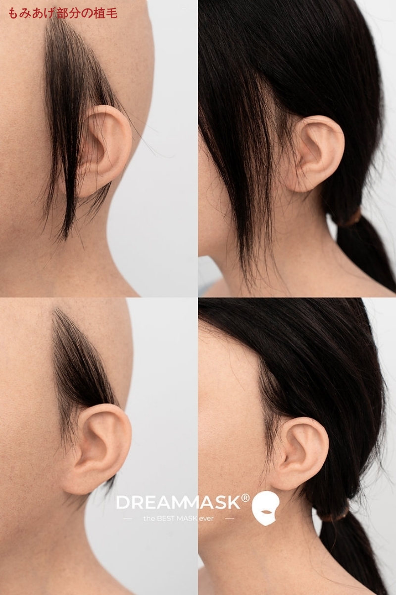 M32SR「Rosina ロージーナ」特別版 高品質 医療用シリコン素材製 授乳体験 E+カップ相当 アジア美人顔 眉毛植毛 ノーマルメイク/ビューティーメイク 超リアル フィット感のすごいフィメールマスク 正規品保証 全国送料無料-13 M32SR「Rosina ロージーナ」特別版 高品質 医療用シリコン素材製 授乳体験 E+カップ相当 アジア美人顔 眉毛植毛 ノーマルメイク/ビューティーメイク 超リアル フィット感のすごいフィメールマスク 正規品保証 全国送料無料-13